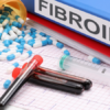 Fibroid