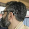Cochlear implants